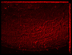 Gene expression in the human fetal eye