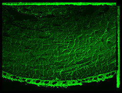 Gene expression in the human fetal eye