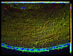 Gene expression in the human fetal eye