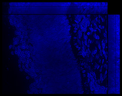 Gene expression in the human fetal eye
