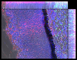 Gene expression in the human fetal eye
