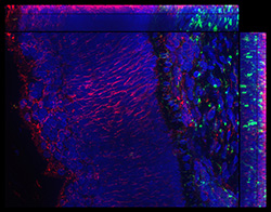 Gene expression in the human fetal eye