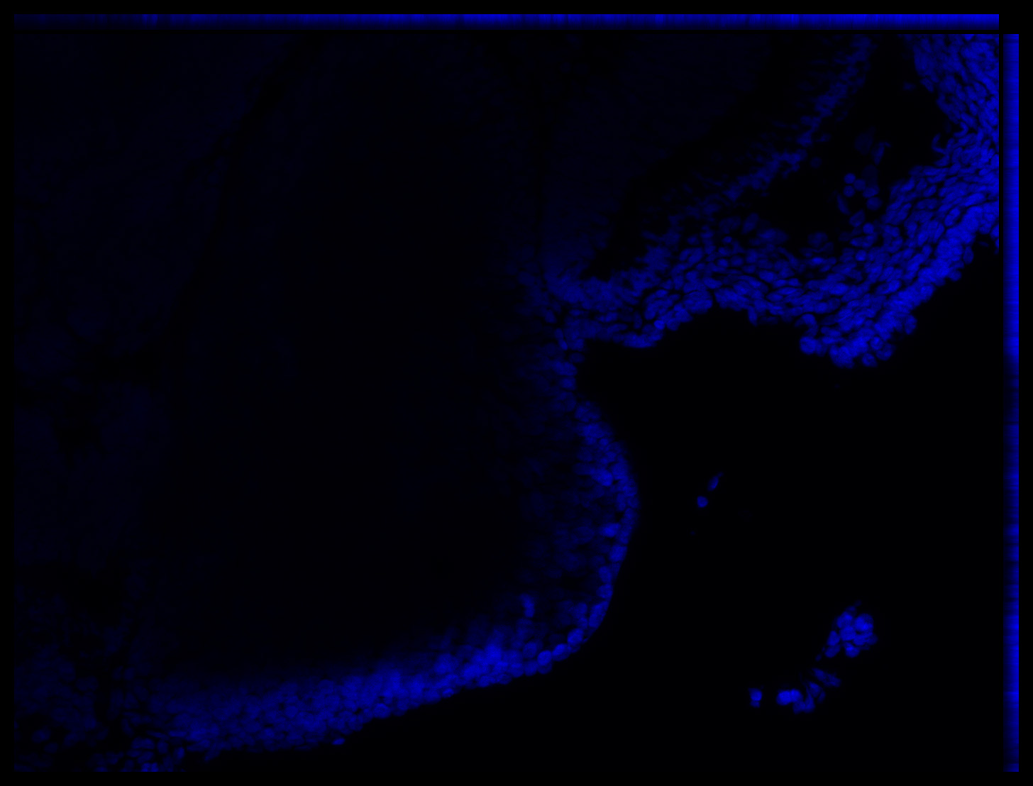 Gene expression in the human embryonic eye