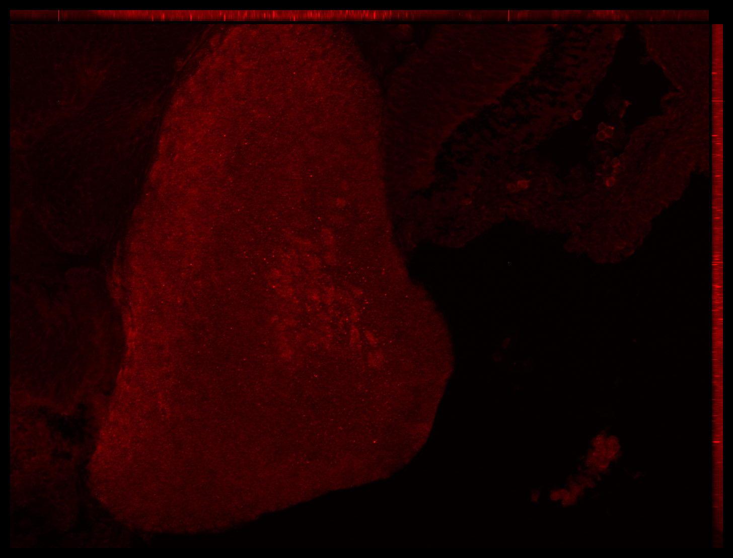 Gene expression in the human embryonic eye