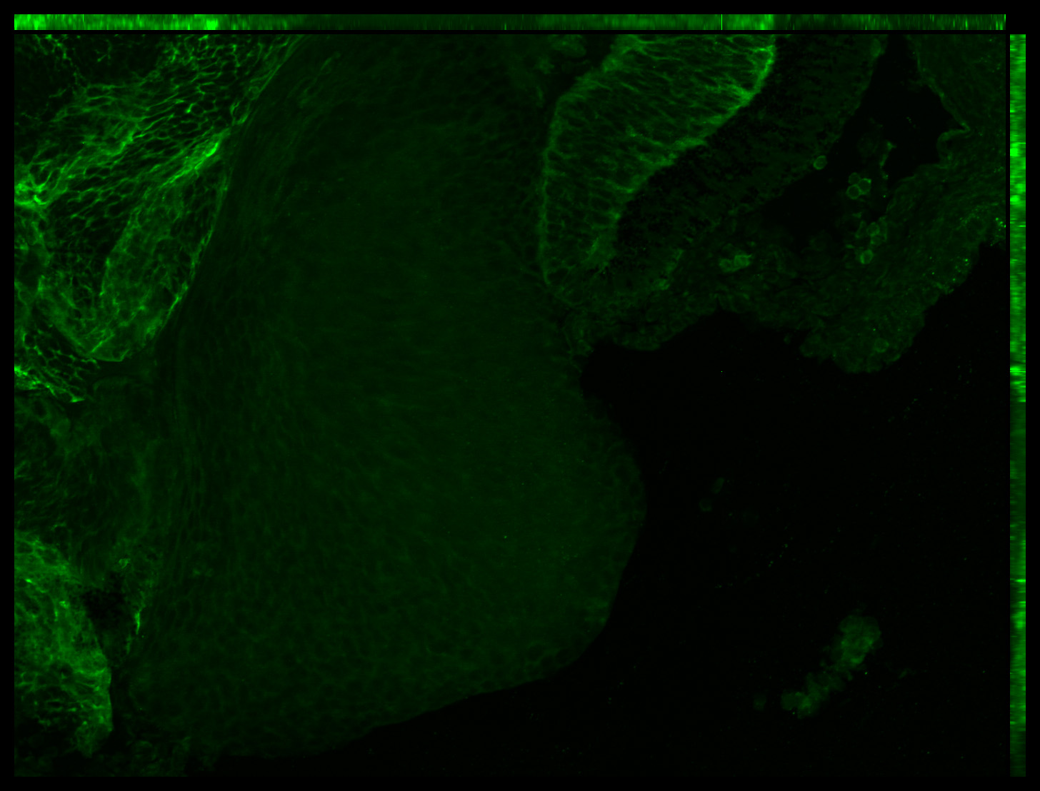 Gene expression in the human embryonic eye