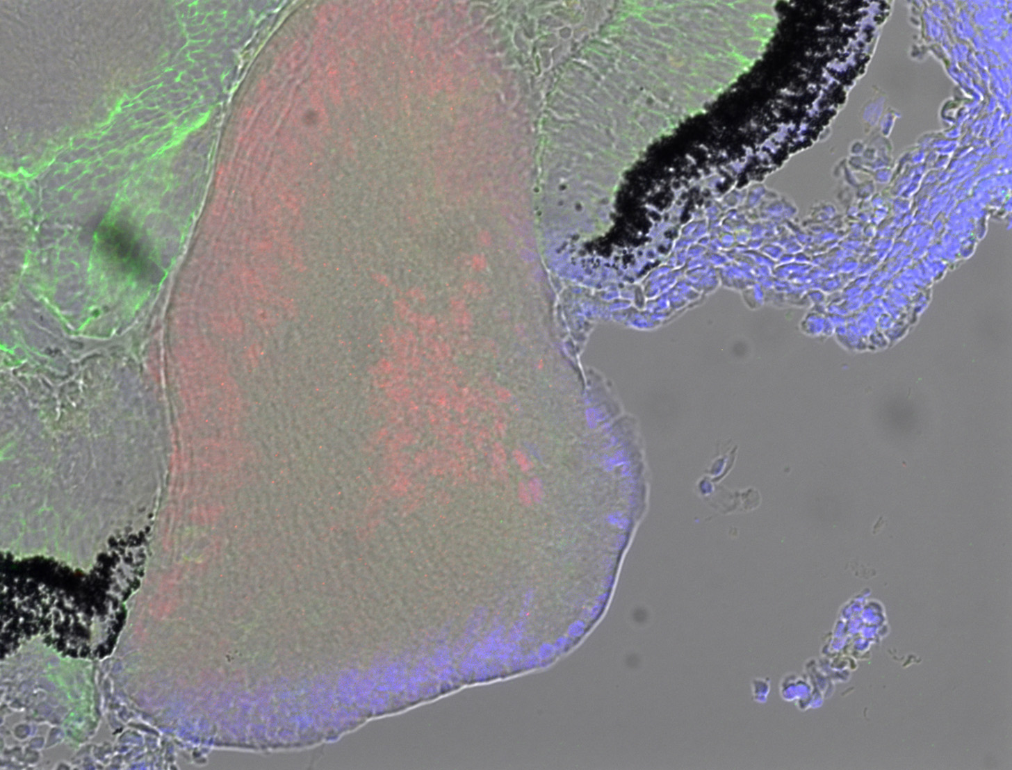 Gene expression in the human embryonic eye