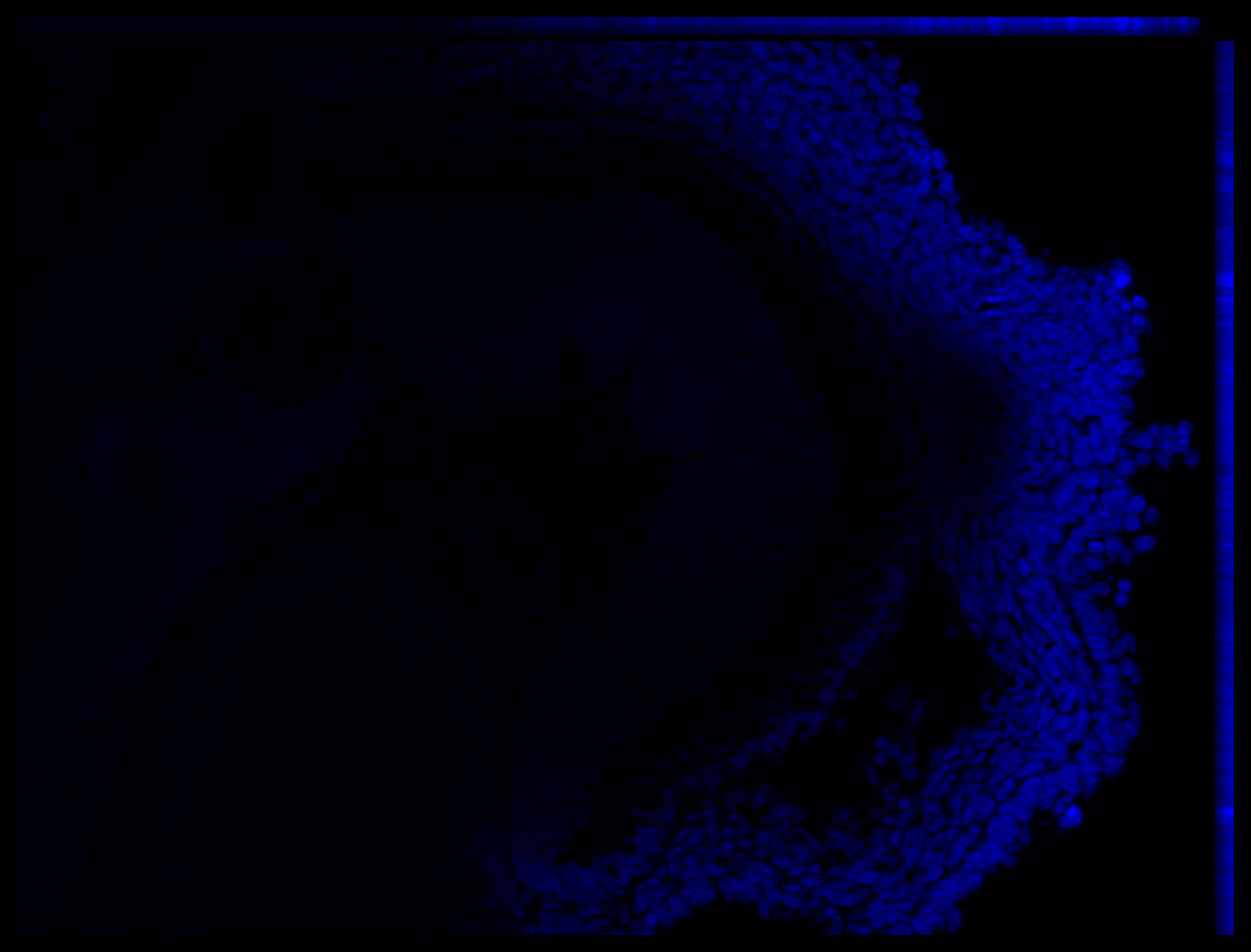 Gene expression in the human embryonic eye