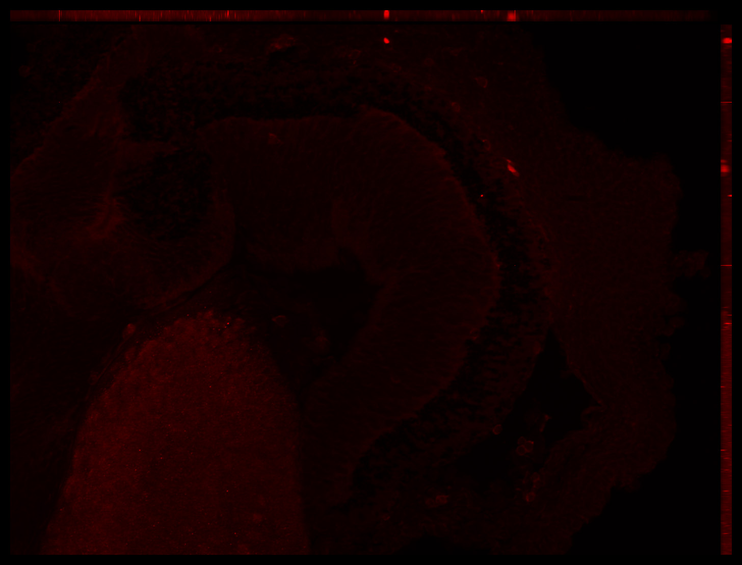 Gene expression in the human embryonic eye