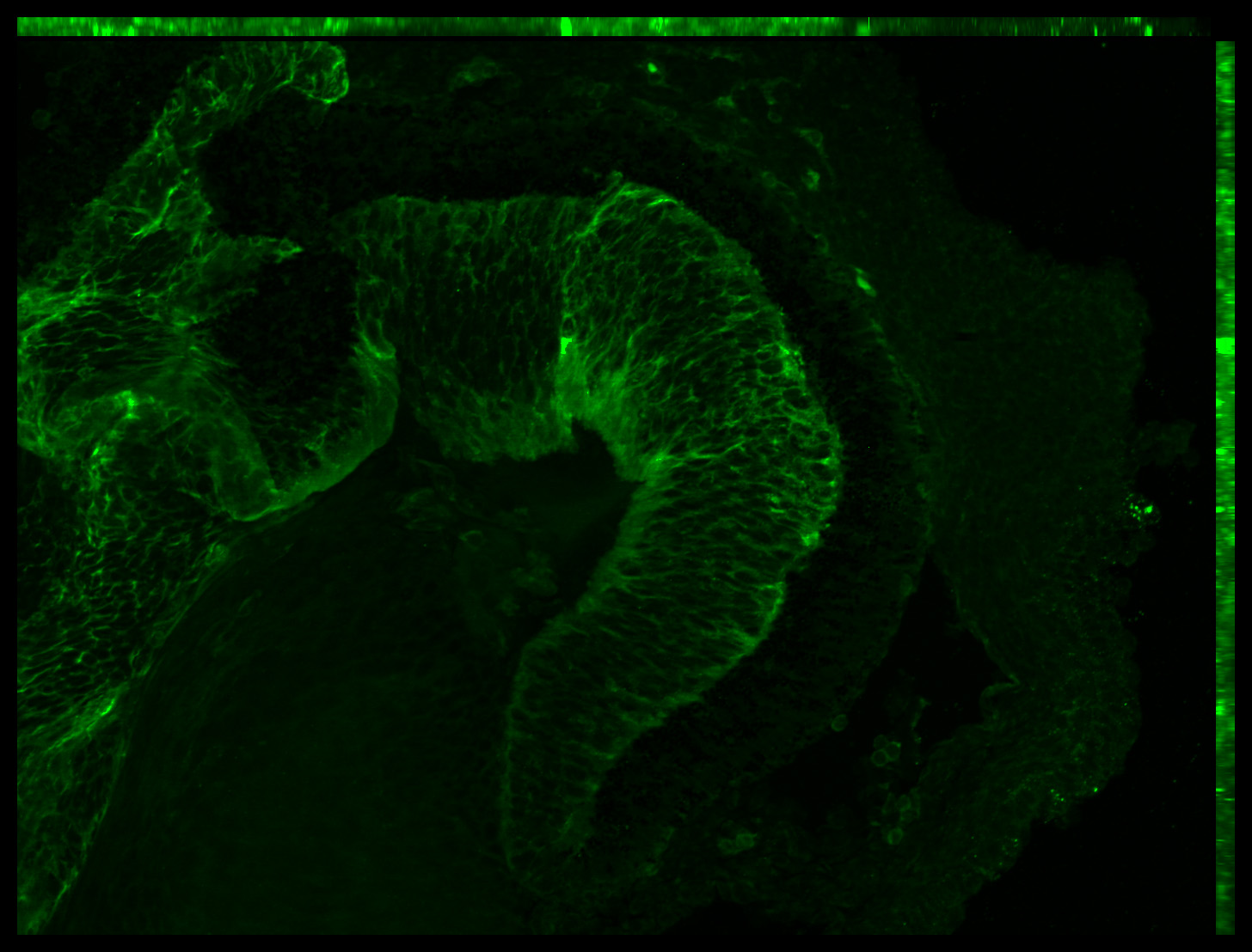 Gene expression in the human embryonic eye