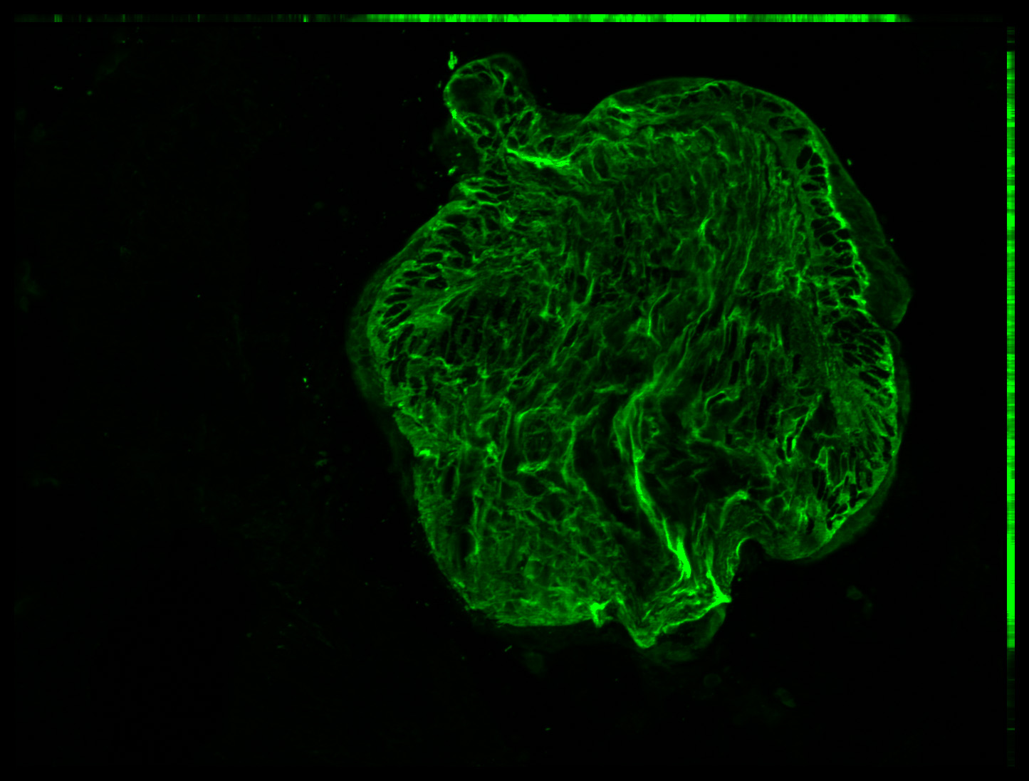Gene expression in the human embryonic eye