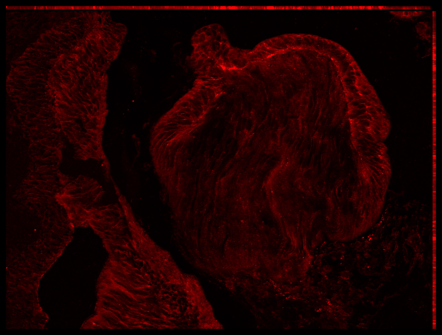 Gene expression in the human embryonic eye