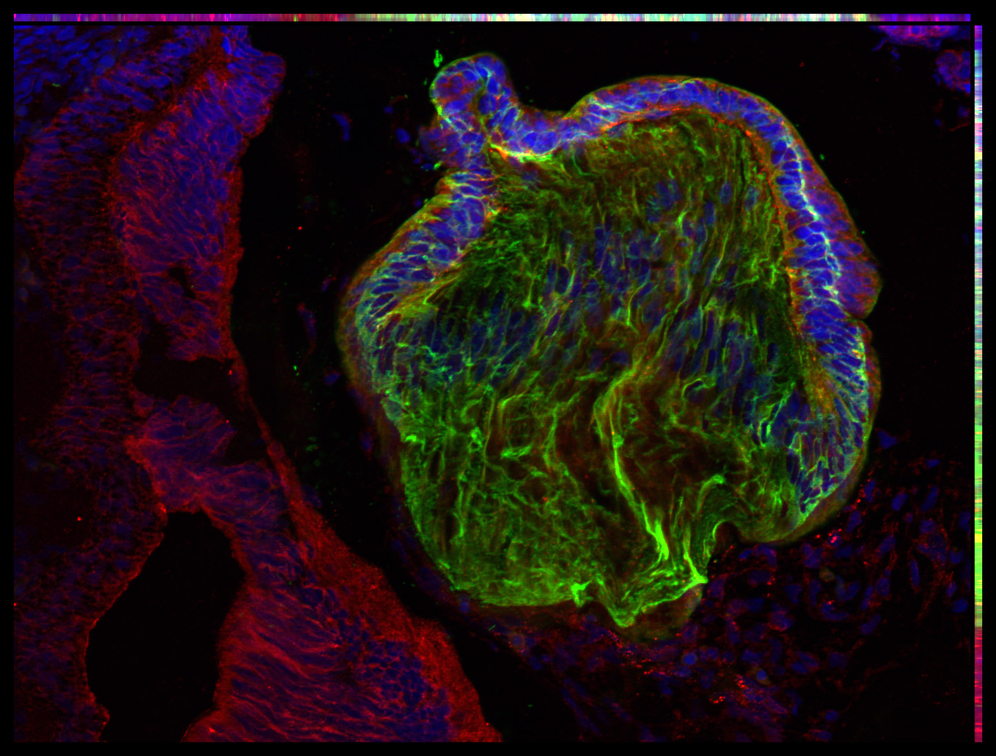 Gene expression in the human embryonic eye