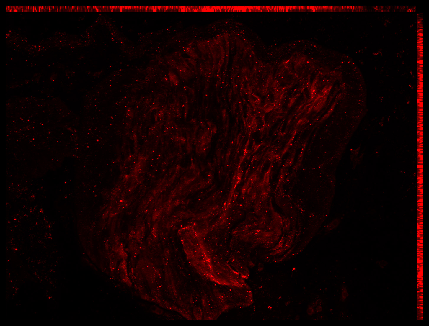 Gene expression in the human embryonic eye