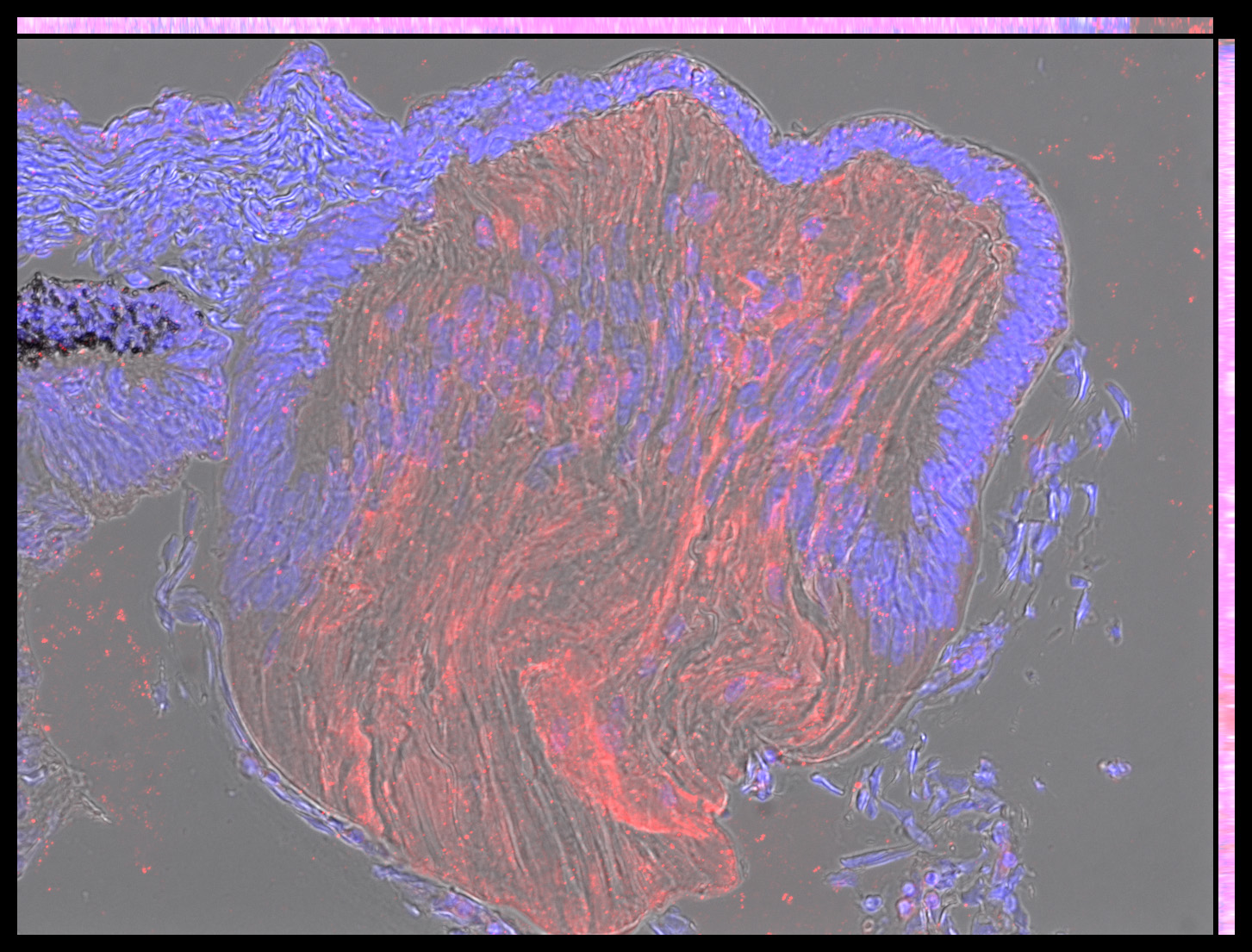 Gene expression in the human embryonic eye