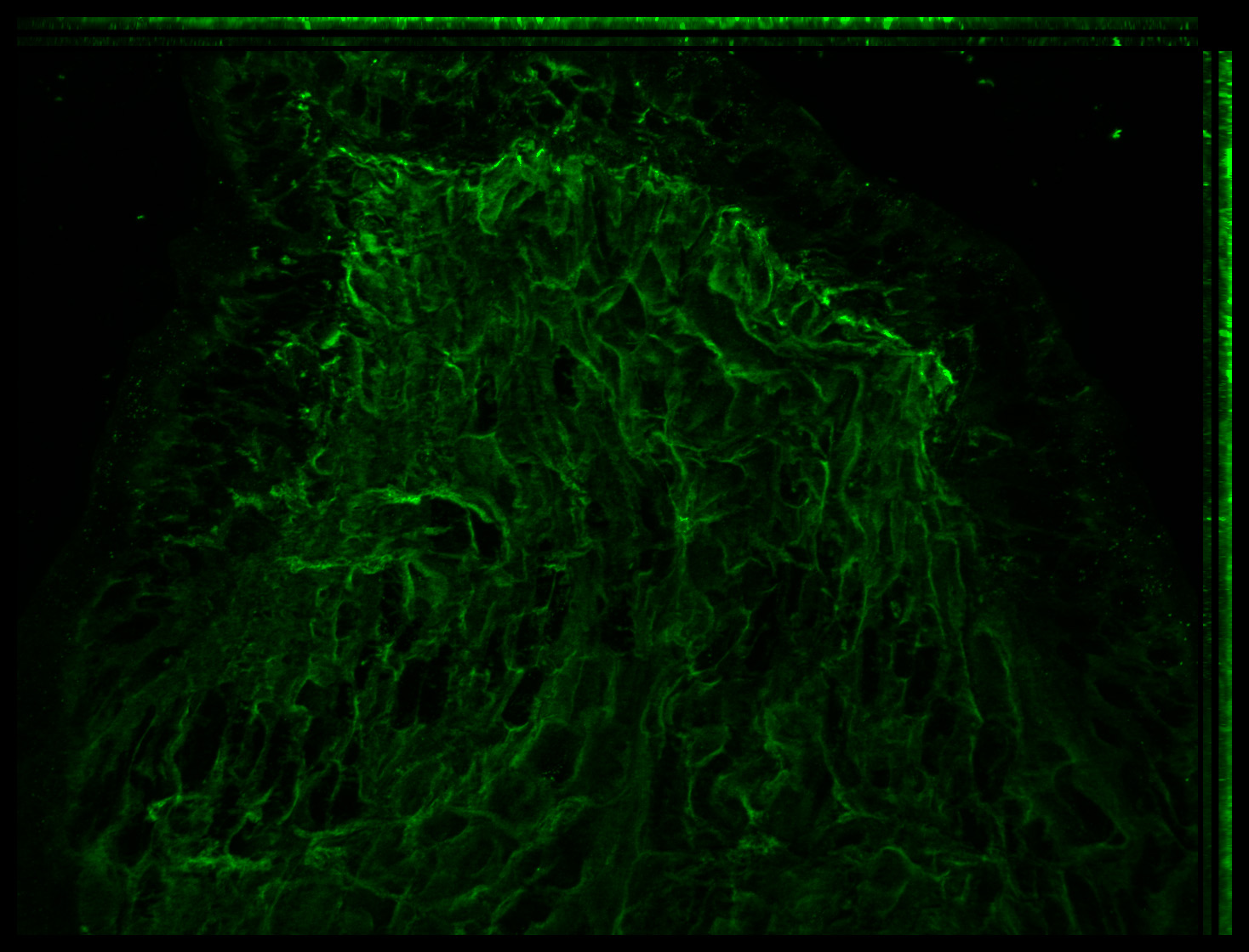 Gene expression in the human embryonic eye