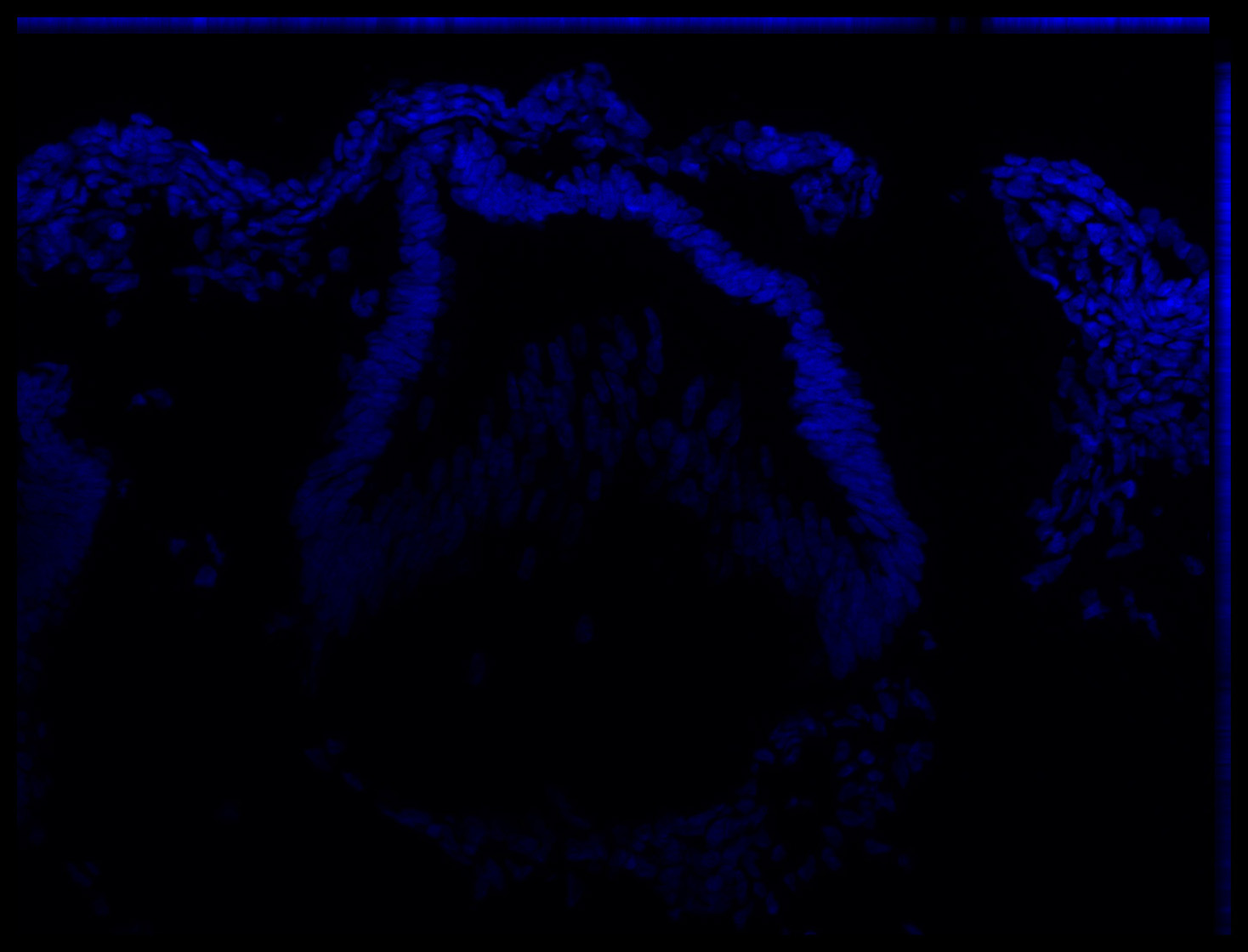 Gene expression in the human embryonic eye