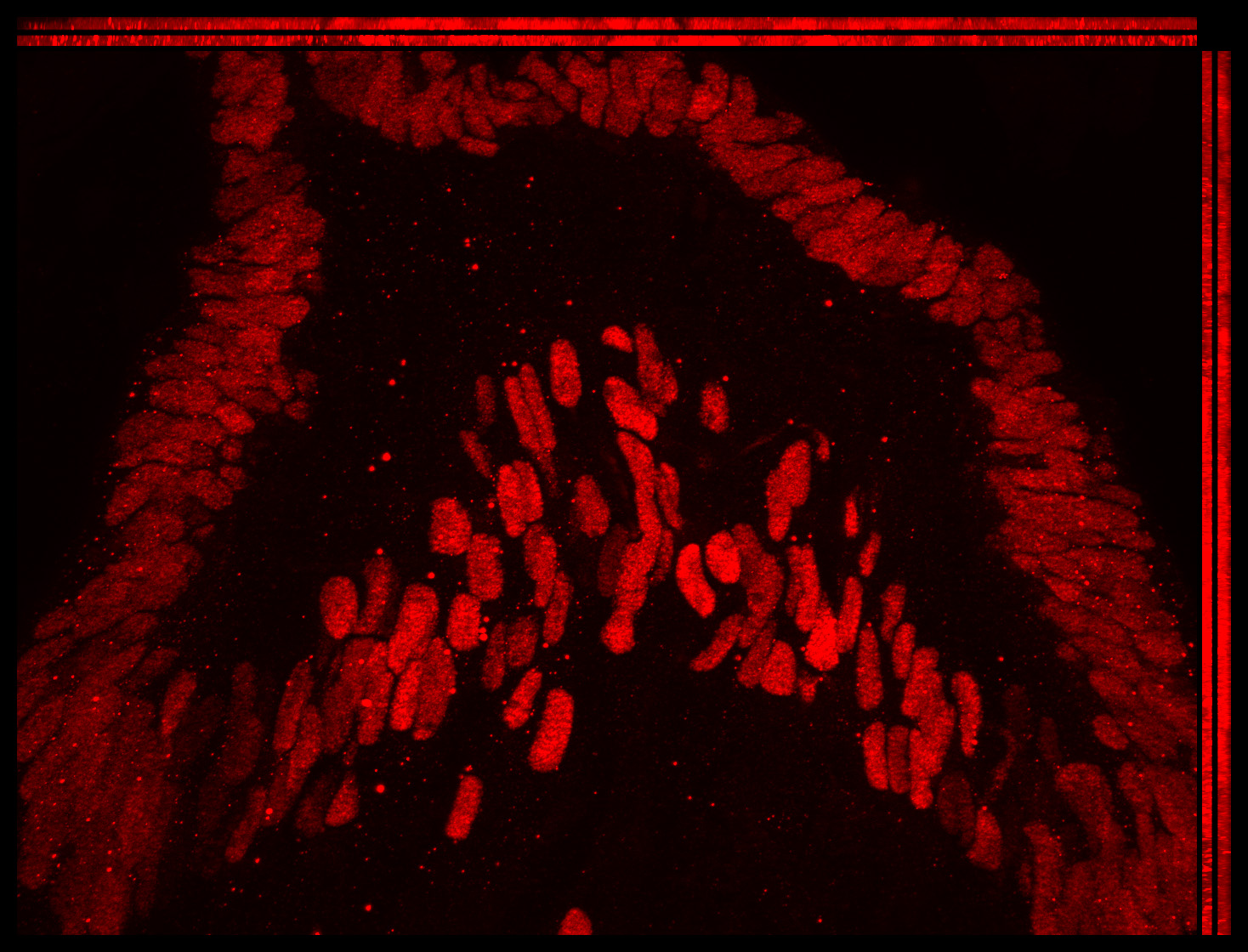 Gene expression in the human embryonic eye