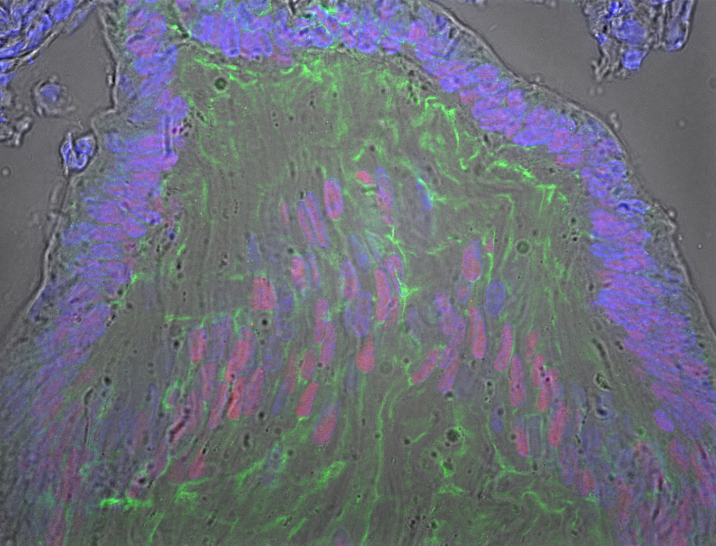 Gene expression in the human embryonic eye