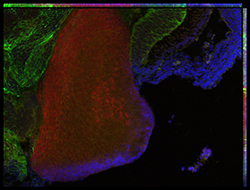 Gene expression in the human embryonic eye