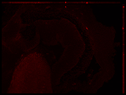 Gene expression in the human embryonic eye