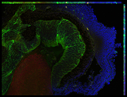 Gene expression in the human embryonic eye