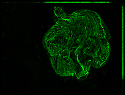 Gene expression in the human embryonic eye