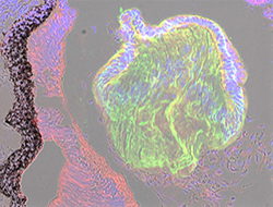 Gene expression in the human embryonic eye