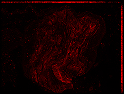Gene expression in the human embryonic eye