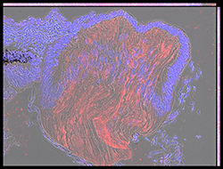 Gene expression in the human embryonic eye
