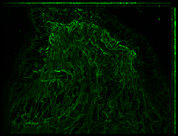 Gene expression in the human embryonic eye