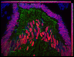Gene expression in the human embryonic eye
