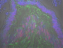 Gene expression in the human embryonic eye