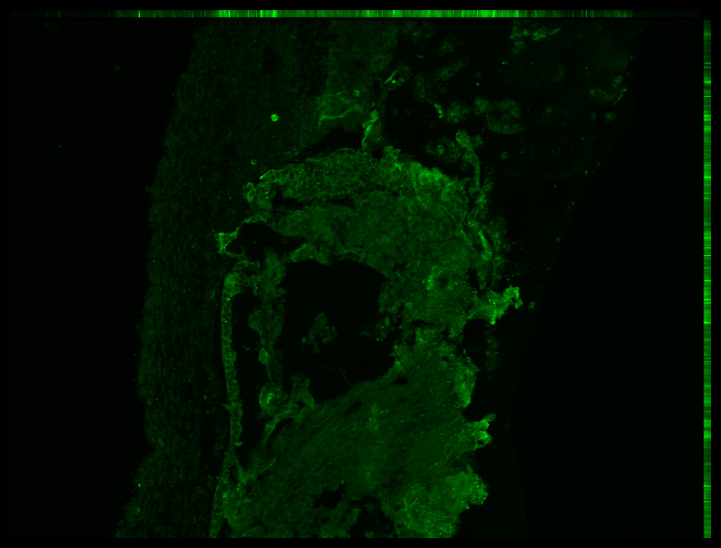 Gene expression in the human embryonic eye