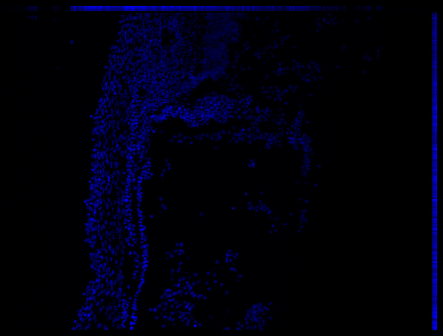Gene expression in the human embryonic eye