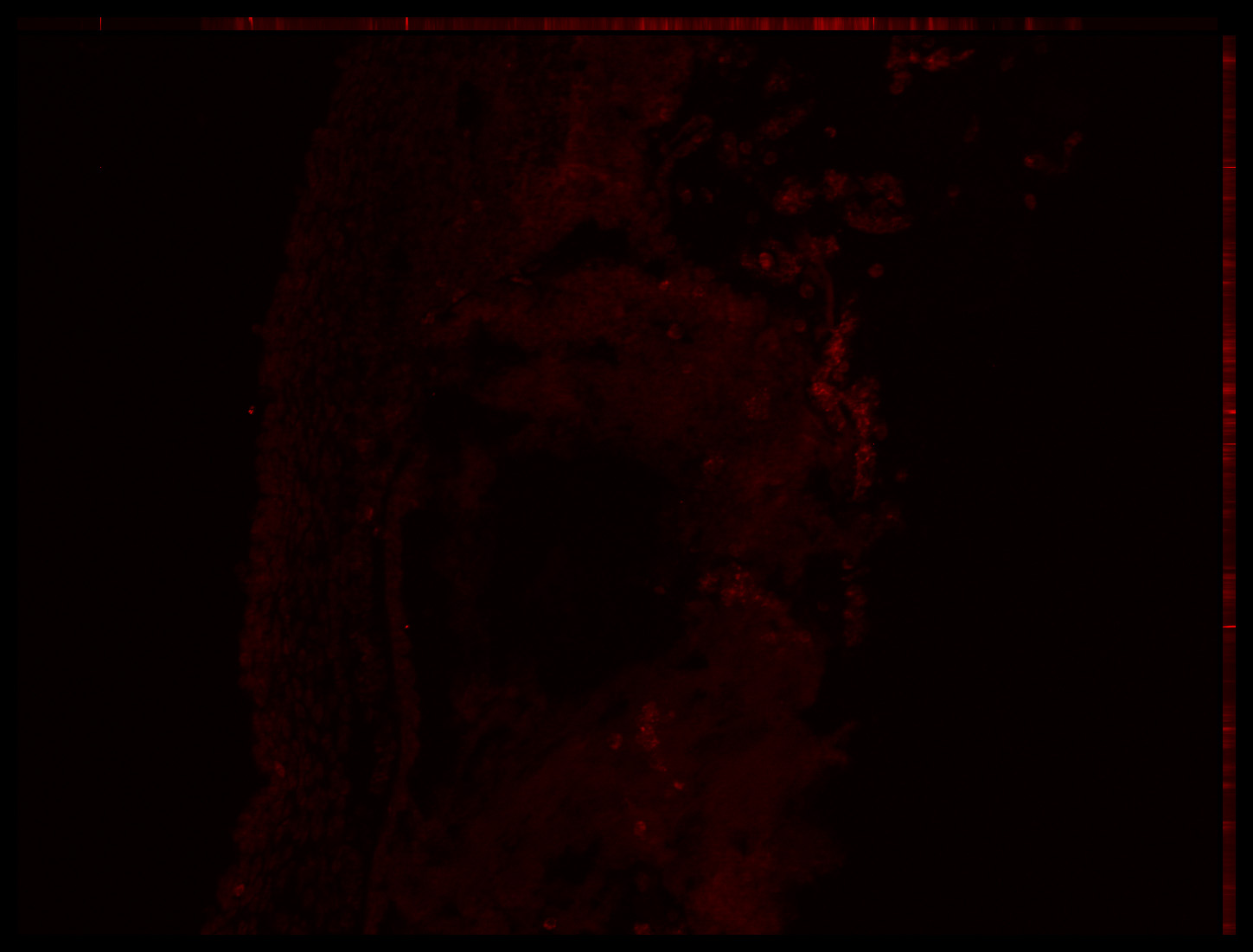 Gene expression in the human embryonic eye