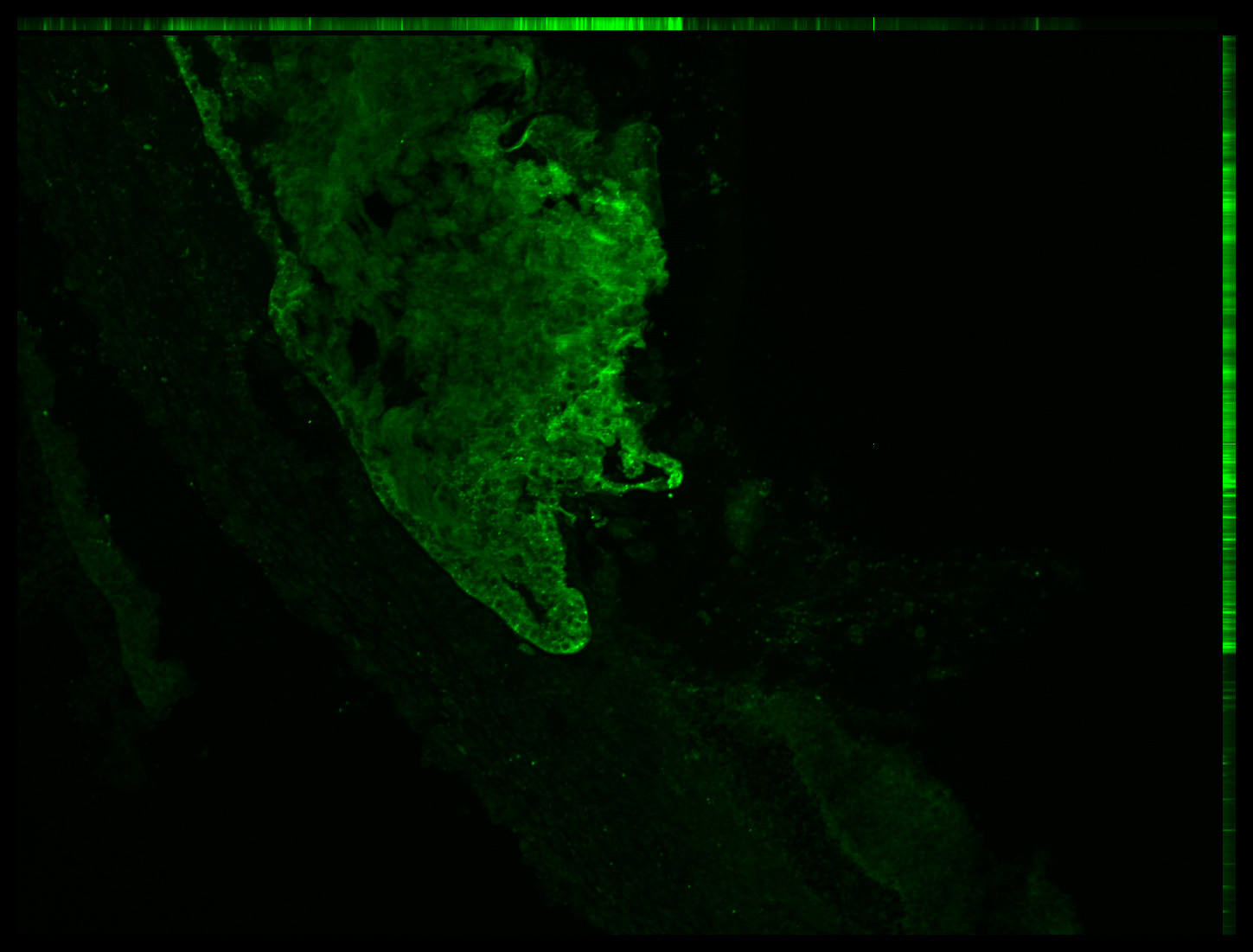 Gene expression in the human embryonic eye