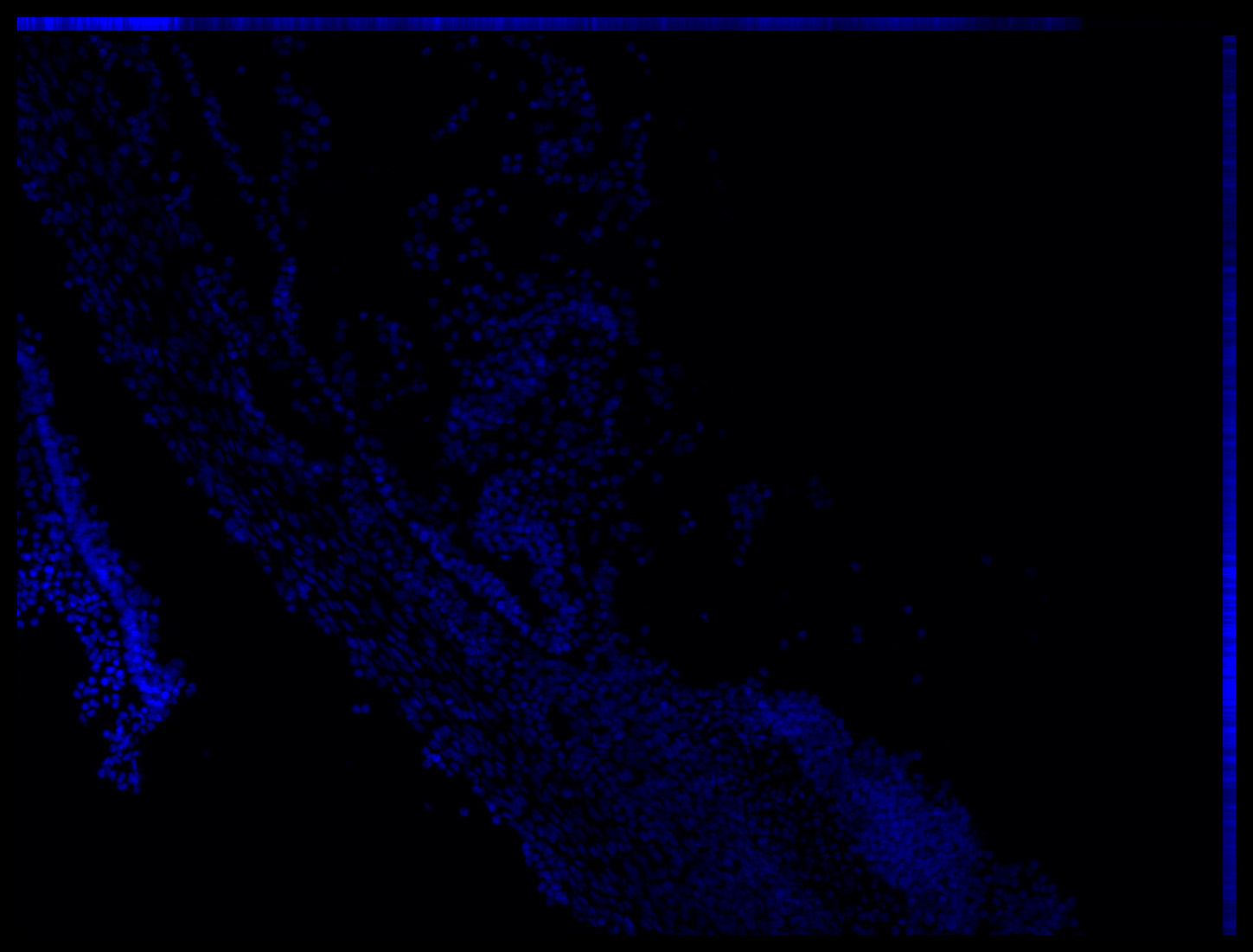 Gene expression in the human embryonic eye