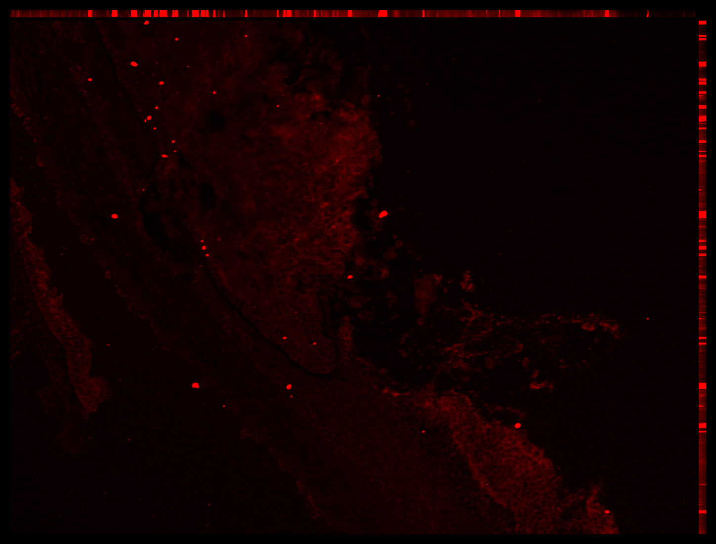 Gene expression in the human embryonic eye