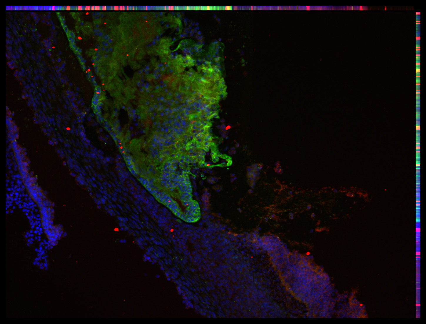 Gene expression in the human embryonic eye