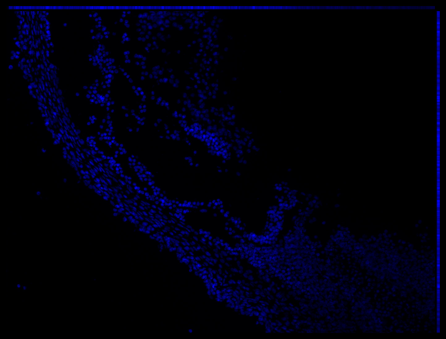 Gene expression in the human embryonic eye