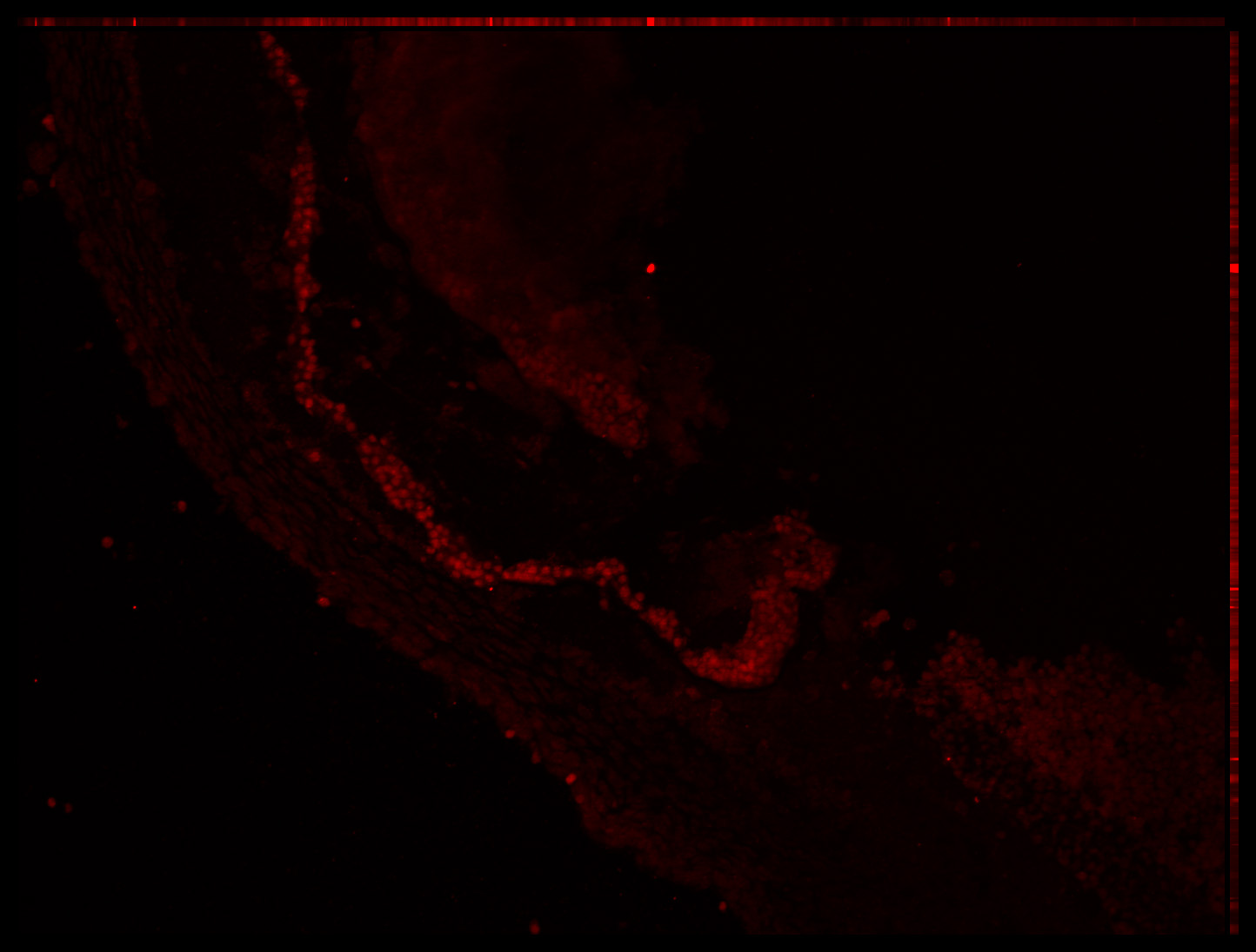 Gene expression in the human embryonic eye