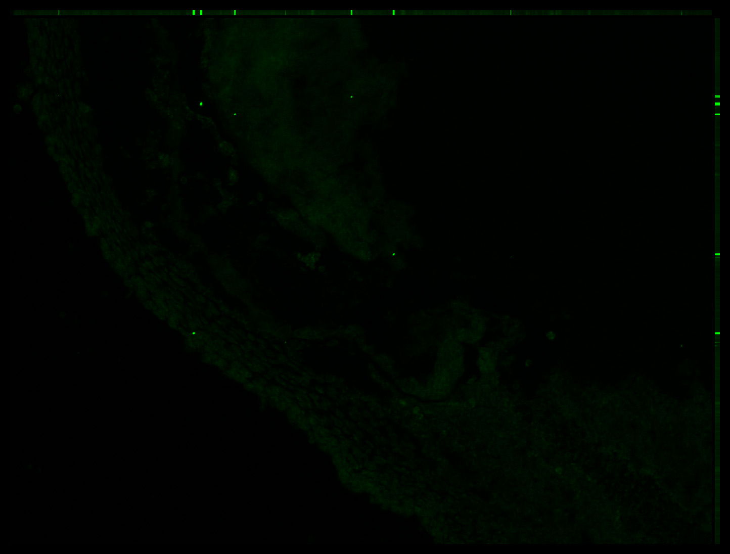 Gene expression in the human embryonic eye