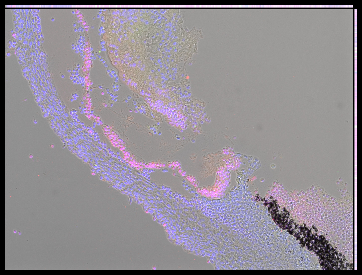 Gene expression in the human embryonic eye