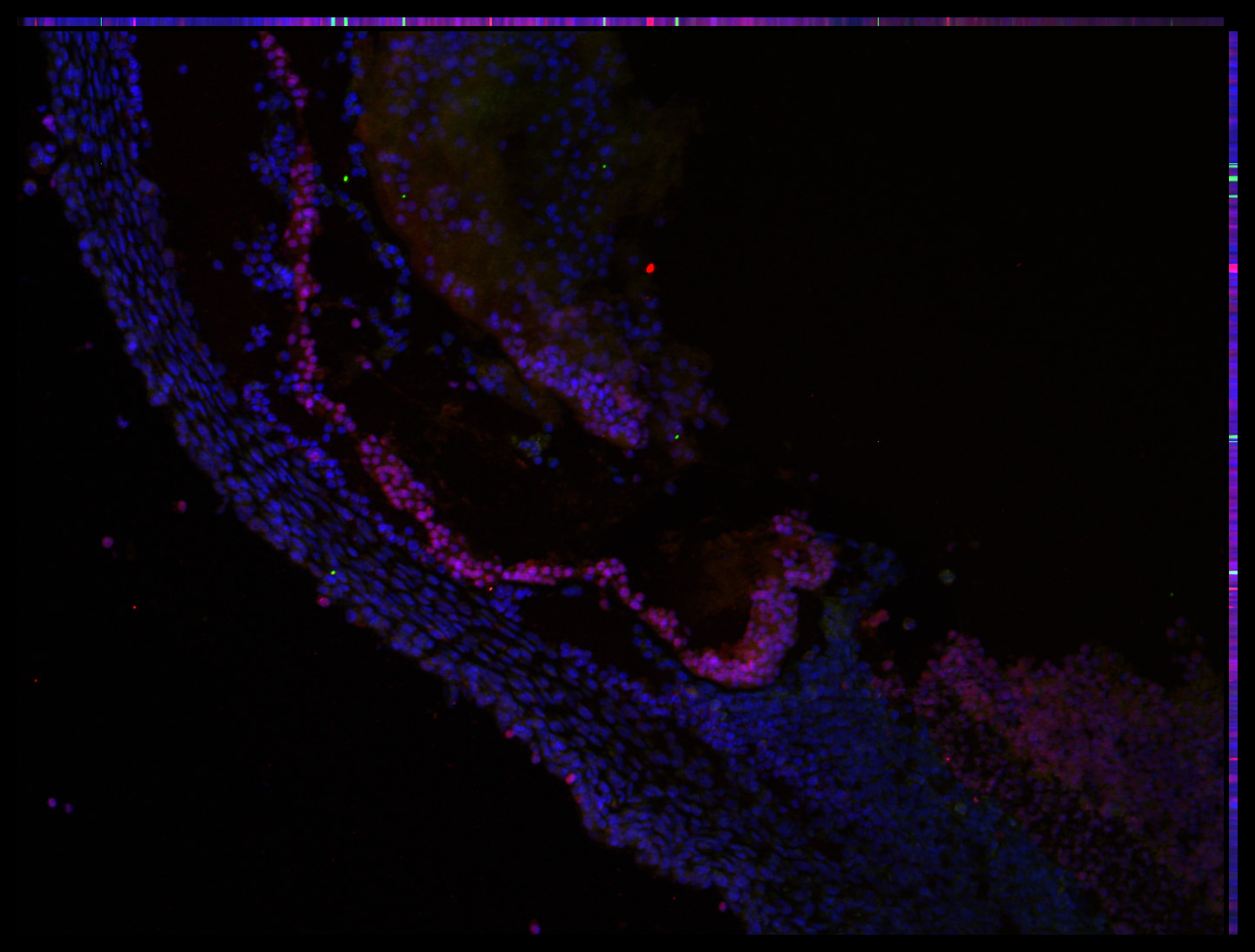 Gene expression in the human embryonic eye