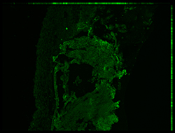 Gene expression in the human embryonic eye