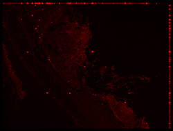 Gene expression in the human embryonic eye