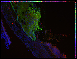 Gene expression in the human embryonic eye