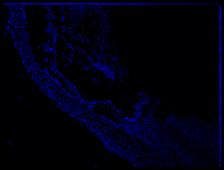 Gene expression in the human embryonic eye