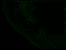 Gene expression in the human embryonic eye