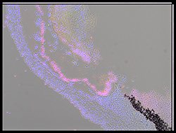 Gene expression in the human embryonic eye